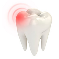 Tooth Extractions